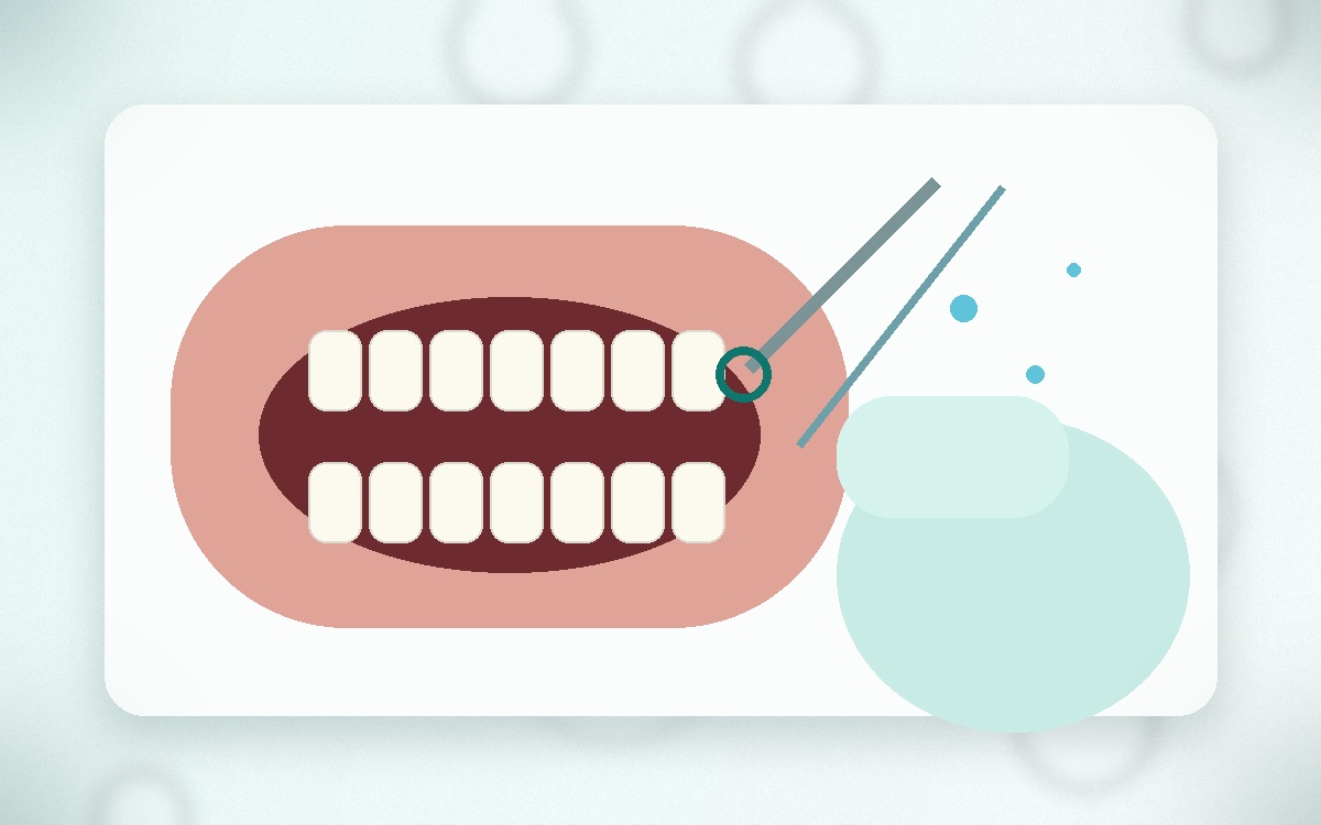 Teeth Cleaning